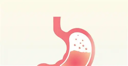 Аденома желудка