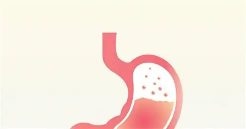 Аденома желудка - симптомы, диагностика, лечение