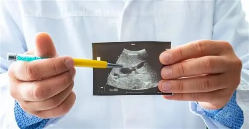 УЗИ желчного пузыря - как интерпретировать результаты?