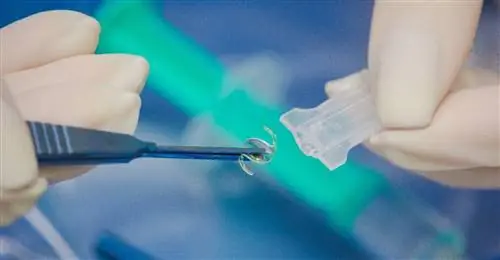 Интраокулярные линзы - современный метод лечения катаракты