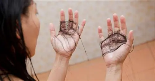 "Я проснулся с подушкой, полной волос." Муж побрил ей голову