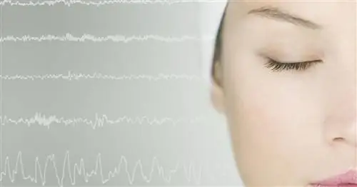 Женщина живет без частички своего мозга. «Врачи были раздражены тем, как я функционировал»