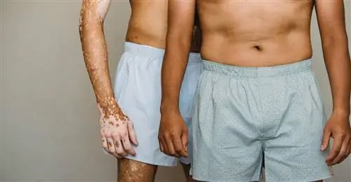 Специалисты советуют раз в месяц пересматривать нижнее белье и выбрасывать то, что не подходит для прогулок.