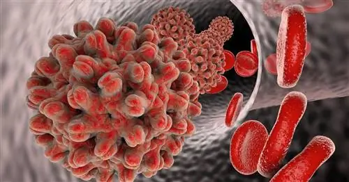 Гепатит С как бомба