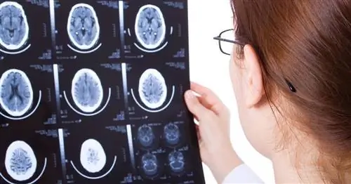 8 болезней, от которых до сих пор нет лекарства