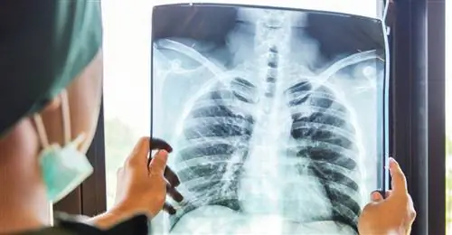 Рак легких - самый большой убийца среди раковых заболеваний