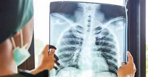 Раннее выявление рака легких спасает жизни