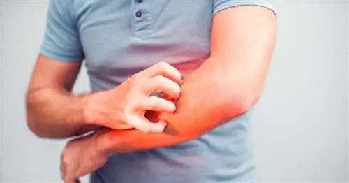 Румяна - как это делается? Симптомы и лечение