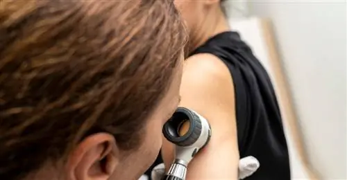 Знаете ли вы, что нужно изменить в своей жизни, чтобы предотвратить рак?