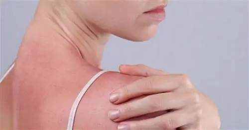 Палытин - естественная защита кожи от солнца