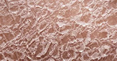 Новат - состав, показания, дозировка, противопоказания