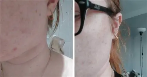 Я тестировала сыворотку SVR SEBIACLEAR Ampoule AZ Flash в течение 14 дней. Эффекты меня очень удивили