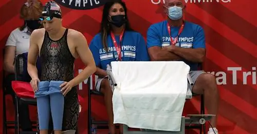 Звезда Паралимпийских игр в Токио родилась с сагиттальной гемимелией. Что это за болезнь?