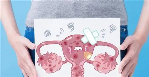 Коварный рак яичников