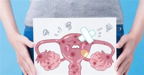 Здоровое питание продлевает жизнь женщинам с раком яичников