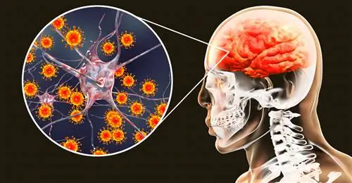 Клещевой энцефалит