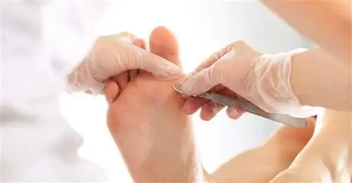 Патчи отпечатков пальцев