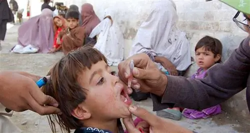 полиомиелит