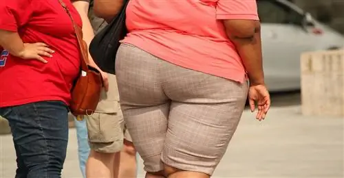 Ожирение в Польше можно лечить хирургическим путем