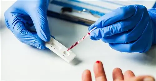 Серологический тест из дисконтного магазина может дать ошибочный результат Серологический тест из дисконтного магазина может дать ошибочный результат