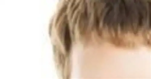 7 главных мифов об эндометриозе