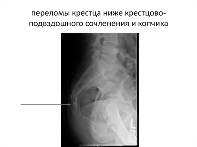 Генетика и медицина: новые горизонты в диагностике и лечении