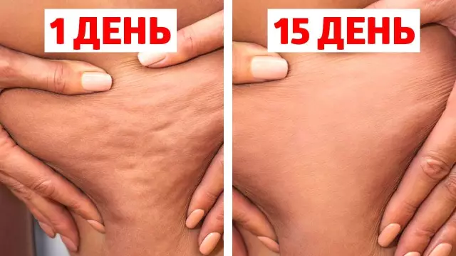 3 самых неожиданных метода, которые навсегда вытеснят целлюлит