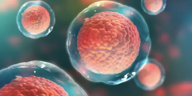 Стволовые клетки восстанавливают очаги инфаркта