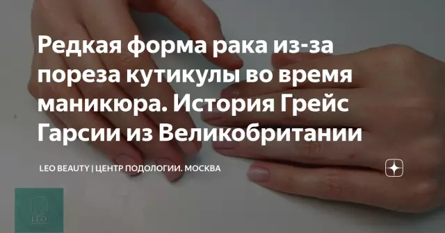Редкая форма рака молочной железы стоит у 9 женщин