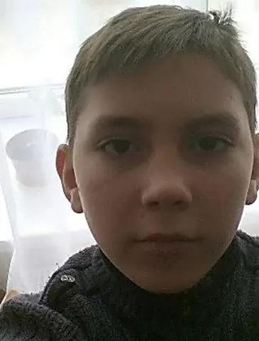Изолированный 13-летний мальчик в Бельгии в качестве подозреваемого случая Эболы