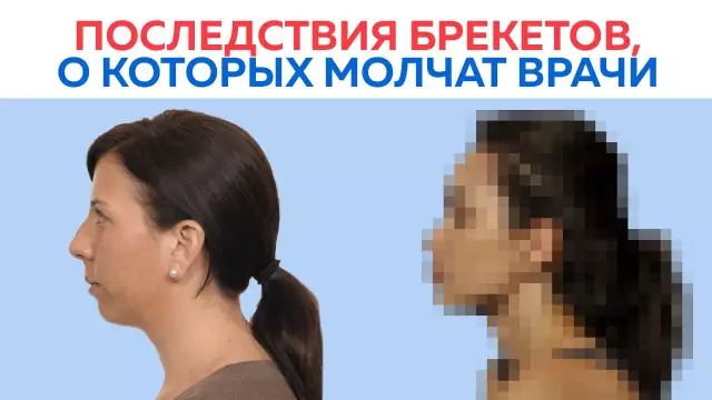 Что врачи PAGNI говорят о 11-летнем, который родил (видео)
