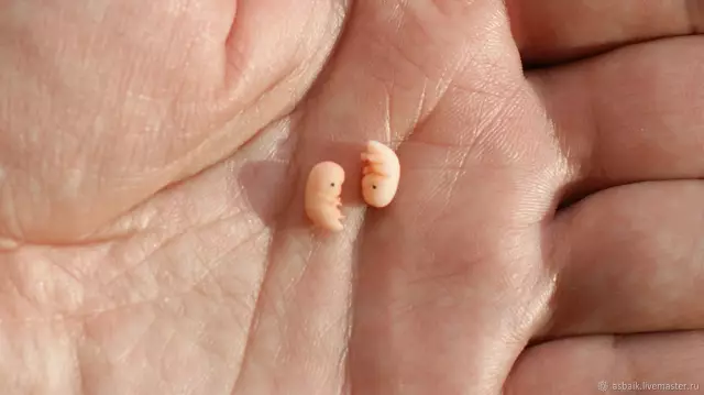 Невероятное видео! Эмбрион "поет" внутри матки