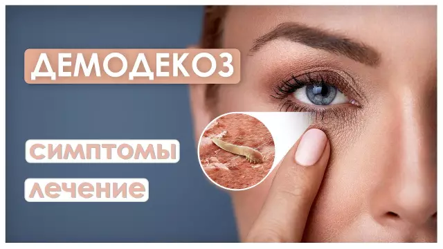 Посмотрите, как клещи век (фото)