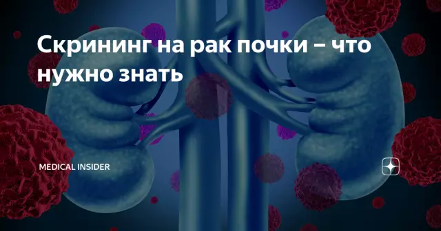 Рак почки: предупреждающие знаки, которые нужно знать