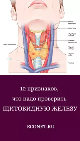 Щитовидная железа: Какие признаки указывают на дисфункцию