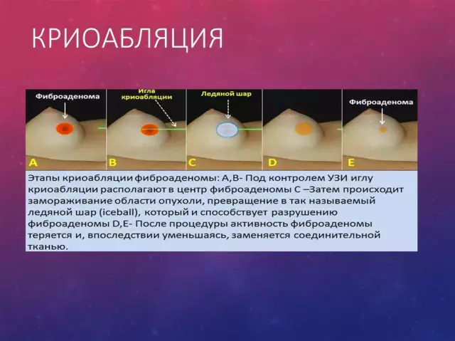 Альтернативные методы лечения бессонницы, тошноты и гипертонии рекомендуются специалистом
