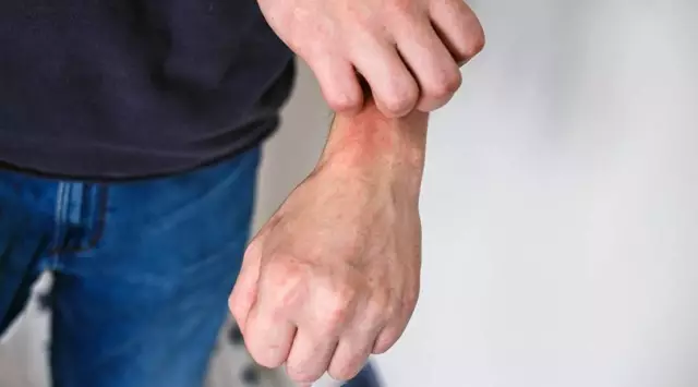 Нерегулируемый диабет: как он влияет на здоровье