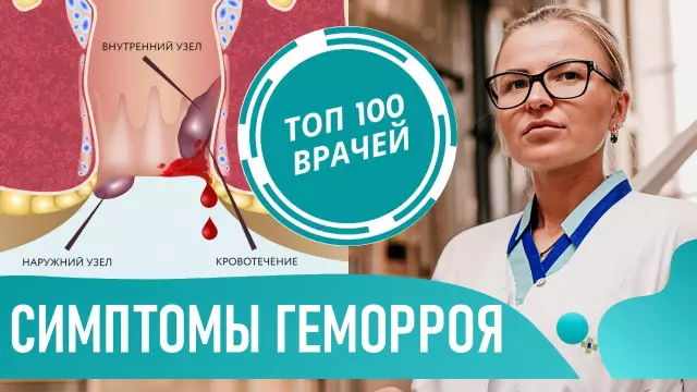 Как предотвратить симптомы геморроя