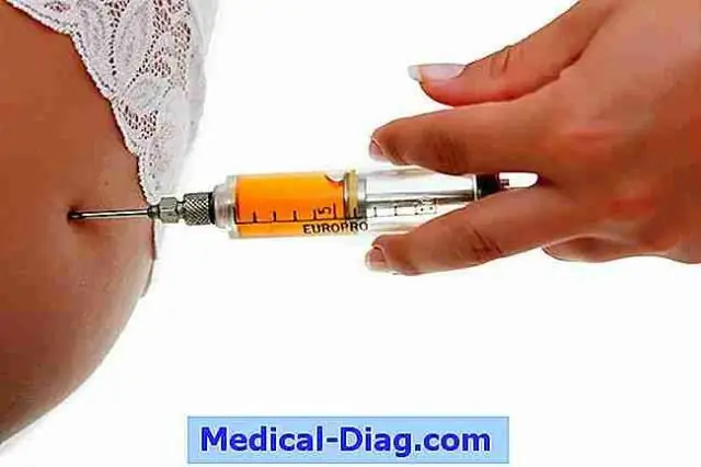 Совместные упражнения при ревматоидном артрите