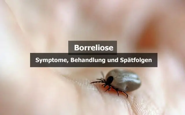 Менингит: симптомы, причины, передача и лечение