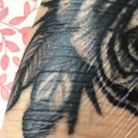 Проблемы беременности обычно нормальны