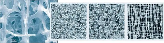 Генетические скрининговые тесты для женщин 35 лет и старше