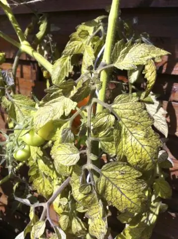 10 вопросов о синдроме беспокойных ног