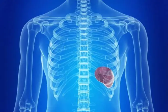 Фиброаденома: симптомы, причины, диагностика и лечение