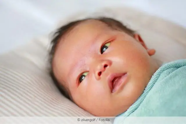 Понимание саркоидоза - симптомы