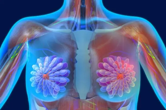 Рак молочной железы: книги, которые могут помочь