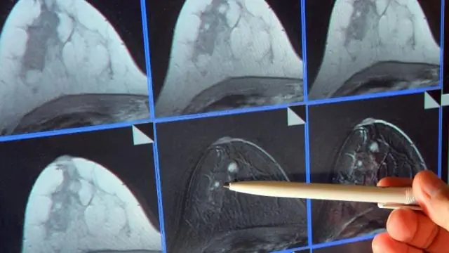 Рак как управляемая болезнь