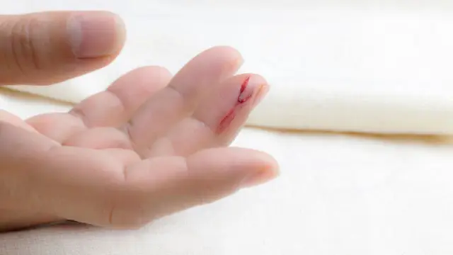 Что такое флебит: симптомы, причины и лечение