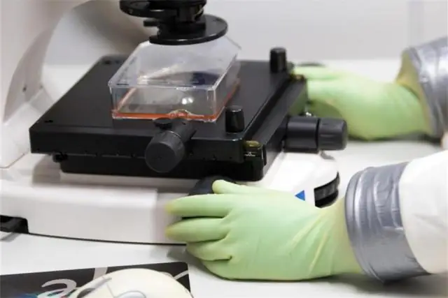 Что такое лихорадка Ласса?