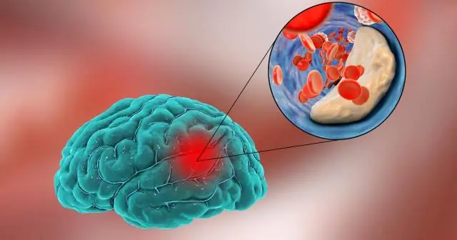 Гепатомегалия: симптомы, причины, диагностика и лечение